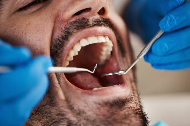 Best Chipped Tooth Repair Near Me  in St Helen, MI